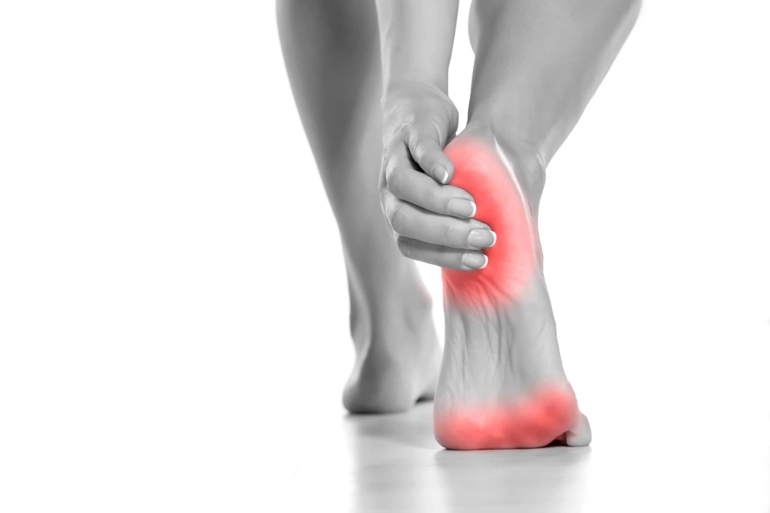plantar fasciitis women